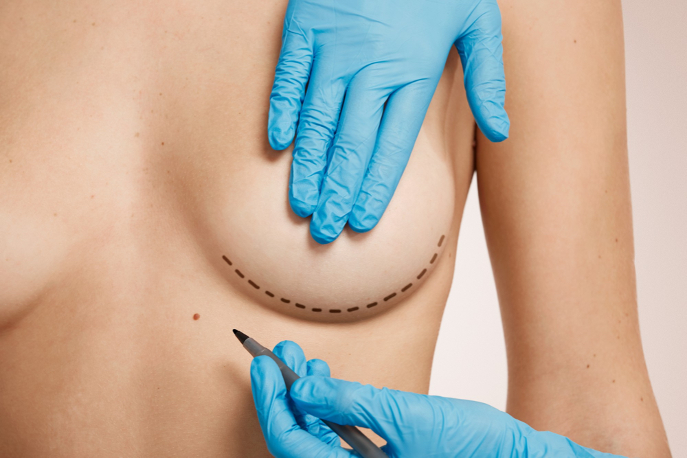 الجراحة التجميلية