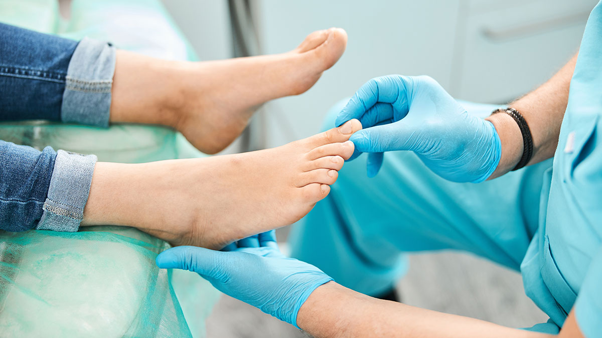 Onychocryptosis or ingrown toenail