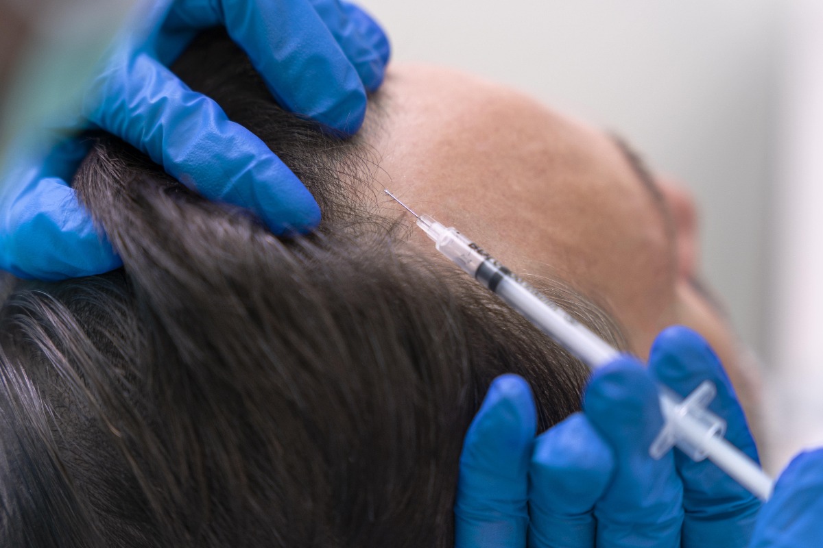 Trichology and Regenerative Medicine
