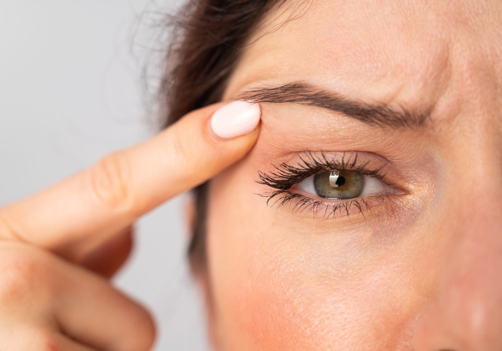 Blepharocalasis: more than just a sign of the times