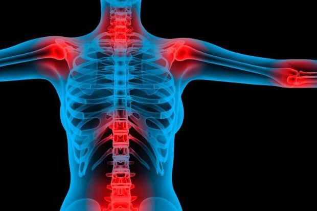 Fibromyalgia: the role of the rheumatologist in diagnosis and clinical management