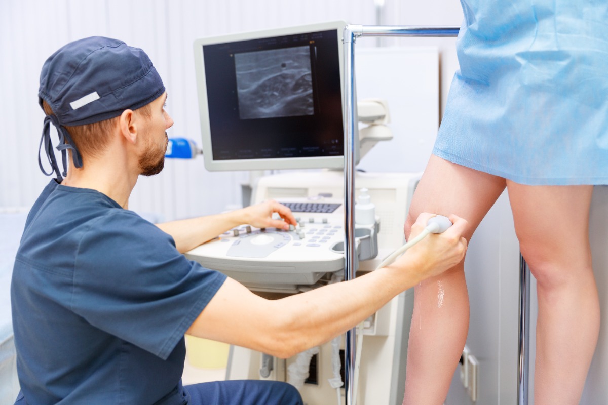 Teleangectasias (capilares), varices, hinchazón de piernas y pesadez nocturna