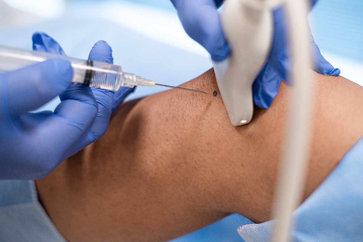 Medicina regenerativa