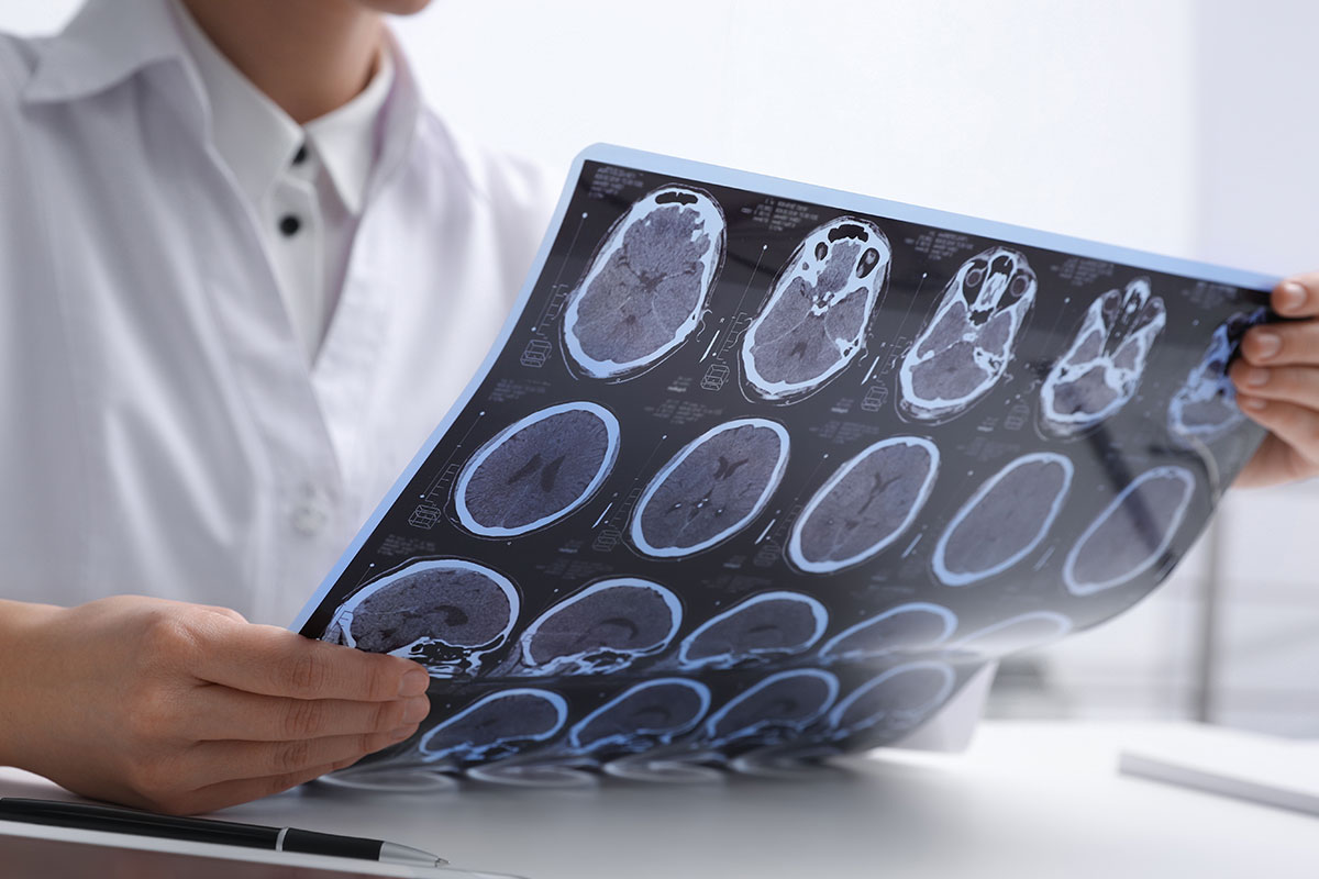Neurochirurgia